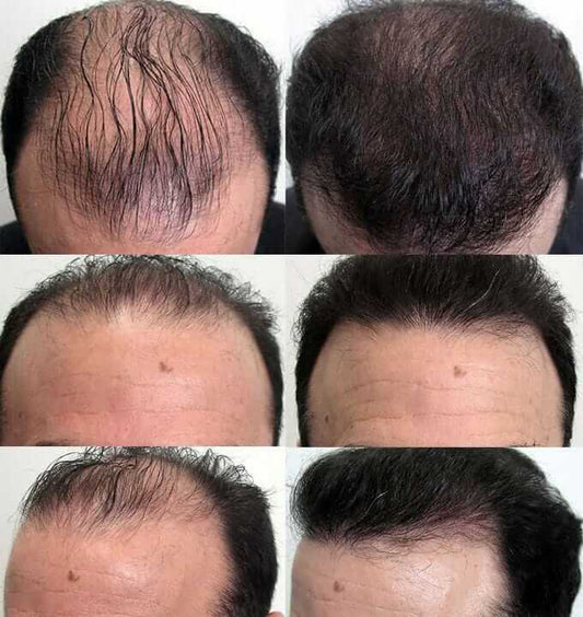 Pure Coco Veda Hair Oil – Hair Fall Control & Growth Care | Strengthens Roots for Thicker, Fuller-Looking Hair